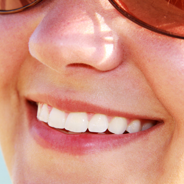The Dangers Of DIY Teeth Whitening