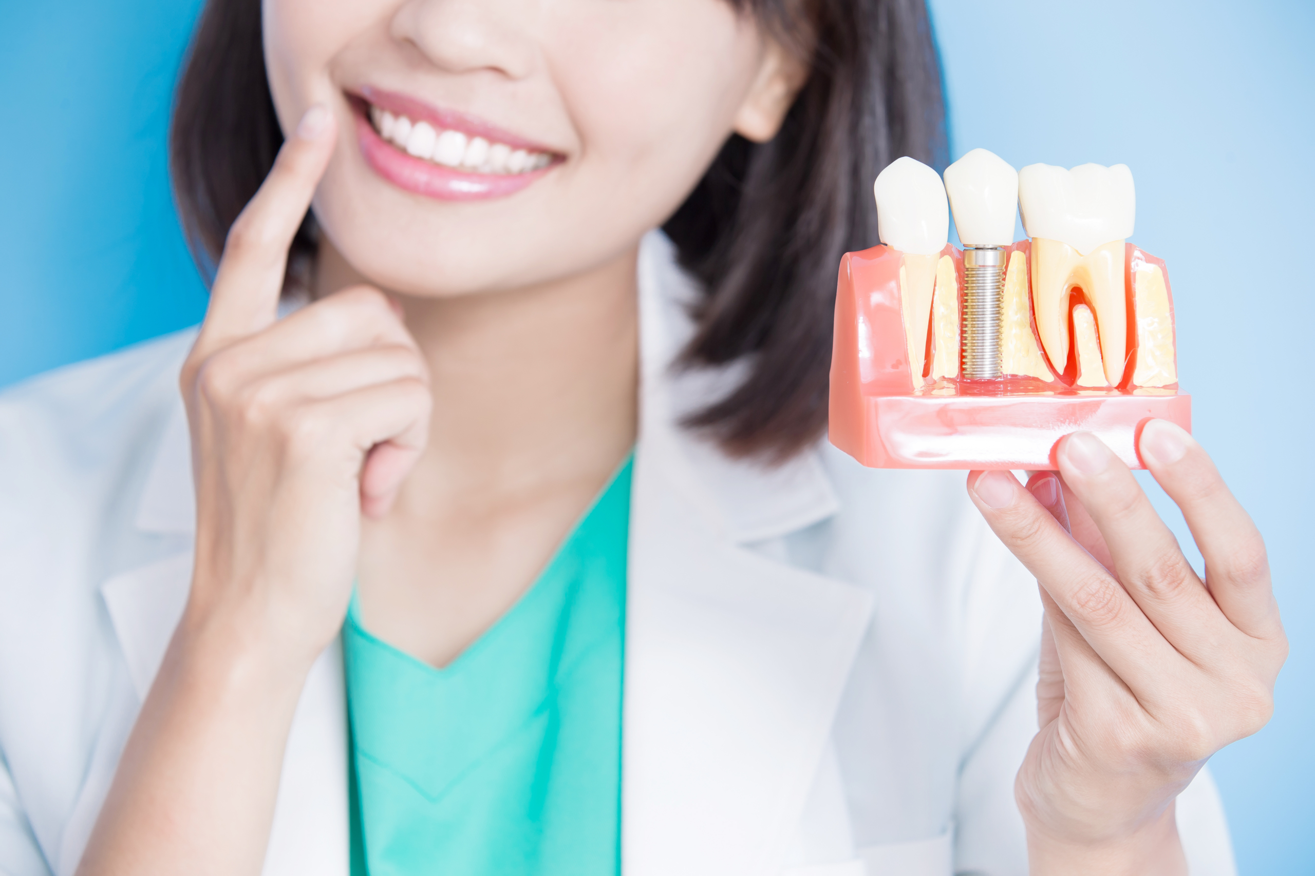 4 Ways Dental Implants Will Change Your Life